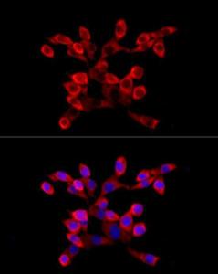 Immunofluorescence analysis of NIH/3T3 cells using Anti-LARP4 Antibody (A11809) at a dilution of 1:100 (40x lens). DAPI was used to stain the cell nuclei (blue)