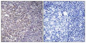 Immunohistochemical analysis of paraffin-embedded human tonsil tissue using Anti-BCAS4 Antibody. The right hand panel represents a negative control, where the Antibody was pre-incubated with the immunising peptide