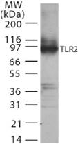 Anti-TLR2 Rabbit Polyclonal Antibody