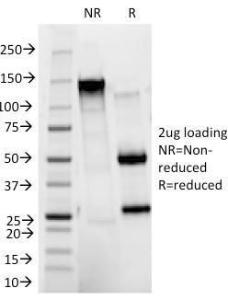 SDS-PAGE analysis of Anti-CD11b Antibody [ITGAM/271] under non-reduced and reduced conditions; showing intact IgG and intact heavy and light chains, respectively. SDS-PAGE analysis confirms the integrity and purity of the antibody