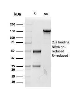 SDS-PAGE analysis of Anti-RBP4 Antibody [RBP4/4042] under non-reduced and reduced conditions; showing intact IgG and intact heavy and light chains, respectively SDS-PAGE analysis confirms the integrity and purity of the antibody