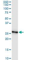 Anti-GSTO2 Rabbit Polyclonal Antibody