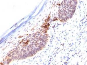 Immunohistochemical analysis of formalin-fixed, paraffin-embedded human skin using Anti-CD1a Antibody [SPM120]