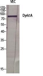 Western blot analysis of various cells using Anti-DYR1A Antibody