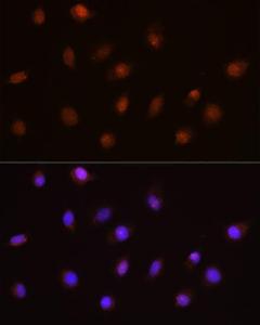 Immunofluorescence analysis of L929 cells using Anti-USP4 Antibody (A305548) at a dilution of 1:100. DAPI was used to stain the cell nuclei (blue)