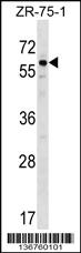 Anti-BMP3 Rabbit Polyclonal Antibody