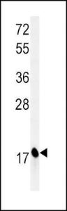 Anti-CPLX1 Rabbit Polyclonal Antibody (Biotin)