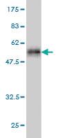 Anti-PCTP Mouse Monoclonal Antibody [clone: 1F9]