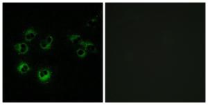 Immunofluorescence analysis of MCF-7 cells using Anti-GPR42 Antibody The right hand panel represents a negative control, where the antibody was pre-incubated with the immunising peptide