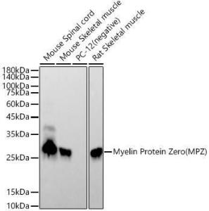 Western blot analysis of extracts of various cell lines, using Anti-Myelin Protein Zero Antibody [ARC53696] (A306501) at 1:10000 dilution. Lysates/proteins were present at 25 µg per laneThe blocking buffer used was 3% non-fat dry milk in TBST.