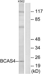 Western blot analysis of lysates from K562 cells using Anti-BCAS4 Antibody. The right hand lane represents a negative control, where the Antibody is blocked by the immunising peptide