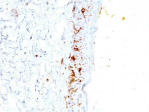 Immunohistochemical analysis of formalin-fixed, paraffin-embedded human skin using Anti-CD1a Antibody [C1A/711]