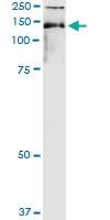 Anti-tim Polyclonal Antibody Pair