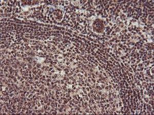 Anti-MGLL Mouse Monoclonal Antibody [clone: OTI1B1]