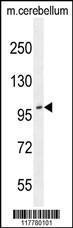 Anti-ADAMTS10 Rabbit Polyclonal Antibody (AP (Alkaline Phosphatase))