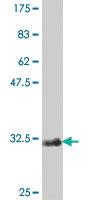 Anti-TMSB4X Mouse Polyclonal Antibody