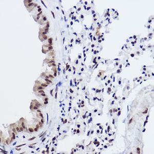 Immunohistochemistry analysis of paraffin-embedded mouse lung using Anti-MED4 Antibody [ARC2528] (A306502) at a dilution of 1:100 (40x lens). Perform high pressure antigen retrieval with 10 mM citrate buffer pH 6.0 before commencing with IHC staining protocol.