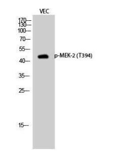 Western blot analysis of VEC cells using Anti-MEK2 (phospho Thr394) Antibody