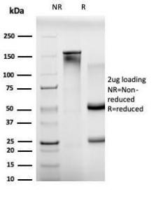 SDS-PAGE analysis of Anti-BCL11A Antibody [PCRP-BCL11A-1H3] under non-reduced and reduced conditions; showing intact IgG and intact heavy and light chains, respectively. SDS-PAGE analysis confirms the integrity and purity of the antibody