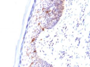 Immunohistochemical analysis of formalin-fixed, paraffin-embedded human skin using Anti-CD1a Antibody [C1A/711]