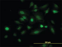 Anti-STAT5B Mouse Monoclonal Antibody [clone: 5D6]