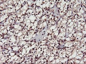 Anti-MGLL Mouse Monoclonal Antibody [clone: OTI1B1]