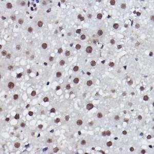 Immunohistochemistry analysis of paraffin-embedded rat liver using Anti-MED4 Antibody [ARC2528] (A306502) at a dilution of 1:100 (40x lens). Perform high pressure antigen retrieval with 10 mM citrate buffer pH 6.0 before commencing with IHC staining protocol.