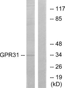 Western blot analysis of lysates from COLO cells using Anti-GPR31 Antibody. The right hand lane represents a negative control, where the Antibody is blocked by the immunising peptide