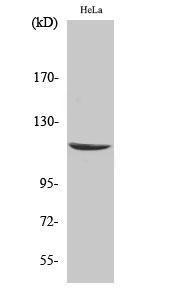 Anti-CARD6 antibody