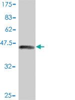 Anti-PML Mouse Polyclonal Antibody