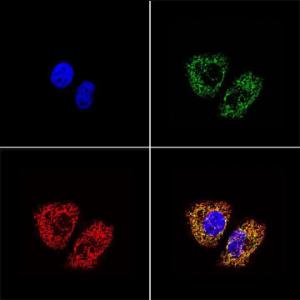 Anti-mtTFA Mouse Monoclonal Antibody [clone: 18G102B2E11]