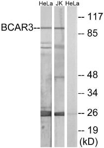 Western blot analysis of lysates from HeLa and Jurkat cells using Anti-BCAR3 Antibody. The right hand lane represents a negative control, where the Antibody is blocked by the immunising peptide