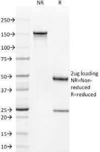 SDS-PAGE analysis of Anti-CD1a Antibody [C1A/711] under non-reduced and reduced conditions; showing intact IgG and intact heavy and light chains, respectively SDS-PAGE analysis confirms the integrity and purity of the antibody