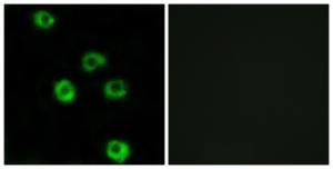 Immunofluorescence analysis of COS7 cells using Anti-LPHN2 Antibody. The right hand panel represents a negative control, where the antibody was pre-incubated with the immunising peptide