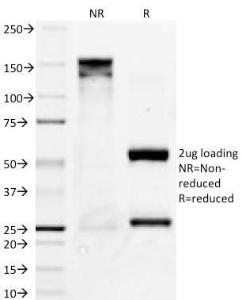 SDS-PAGE analysis of Anti-Bcl-X Antibody [2H12] under non-reduced and reduced conditions; showing intact IgG and intact heavy and light chains, respectively SDS-PAGE analysis confirms the integrity and purity of the antibody