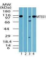 Anti-MTSS1 Rabbit Polyclonal Antibody