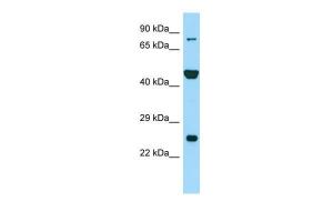 Anti-PADI6 Rabbit Polyclonal Antibody