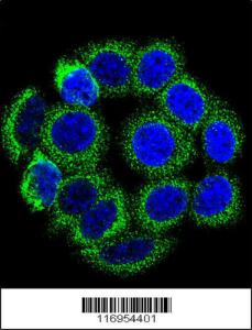 Anti-CYP21A2 Rabbit Polyclonal Antibody