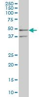 Anti-SEPHS2 Mouse Monoclonal Antibody [clone: 2G9]