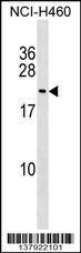 Anti-FUNDC1 Rabbit Polyclonal Antibody (AP (Alkaline Phosphatase))