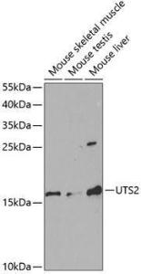 Western blot analysis of extracts of various cell lines, using Anti-Urotensin II Antibody (A11824) at 1:1,000 dilution. The secondary antibody was Goat Anti-Rabbit IgG H&L Antibody (HRP) at 1:10,000 dilution.