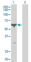 Anti-CDK16 Mouse Monoclonal Antibody [clone: 2E5]