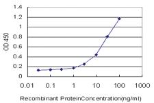 Anti-STAT5B Mouse Monoclonal Antibody [clone: 5D6]