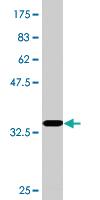 Anti-RPRD1A Mouse Monoclonal Antibody [clone: 1B9]