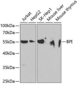 Western blot analysis of extracts of various cell lines, using Anti-BPI Antibody (A11825) at 1:1,000 dilution. The secondary antibody was Goat Anti-Rabbit IgG H&L Antibody (HRP) at 1:10,000 dilution.