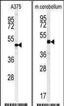 Anti-CACUL1 Rabbit Polyclonal Antibody