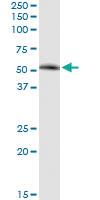 Anti-SIRT7 Polyclonal Antibody Pair