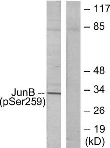 Antibody anti-JUNB phospho SER259 100 µg