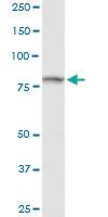 Anti-TRAP1 Rabbit Polyclonal Antibody