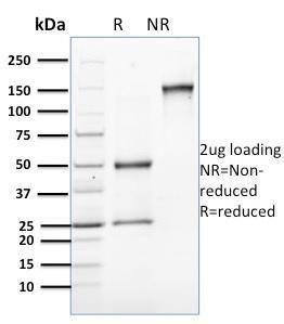 SDS-PAGE analysis of Anti-Involucrin Antibody [SPM259] under non-reduced and reduced conditions; showing intact IgG and intact heavy and light chains, respectively. SDS-PAGE analysis confirms the integrity and purity of the antibody